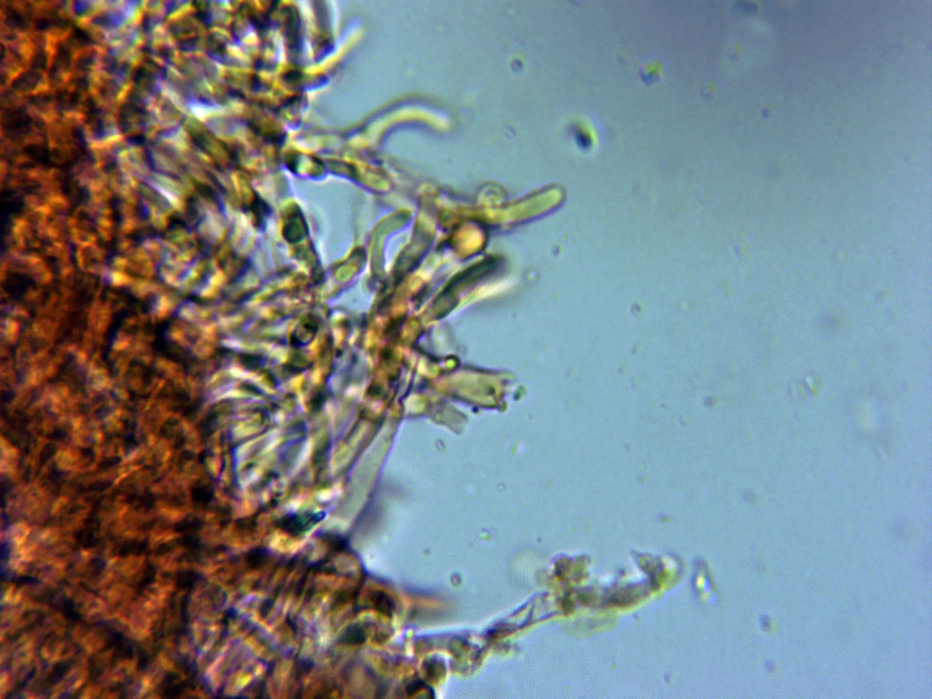 Microscopía de Skeletocutis albocremea - 10 - Basidio tetrasporico